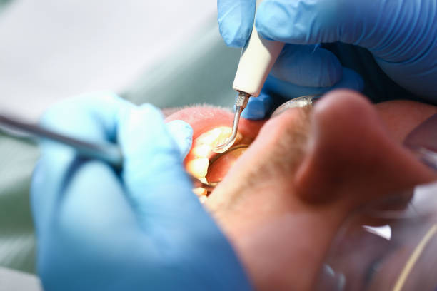 Urgent Tooth Repair in OK